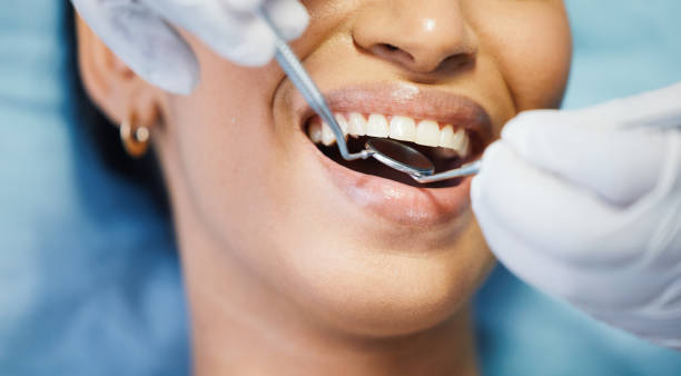 Best Emergency Cosmetic Dentistry (e.g., broken veneers) in Long Creek, IL