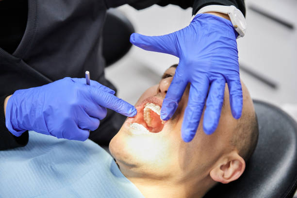 Best Dental Abscess Treatment in Long Creek, IL