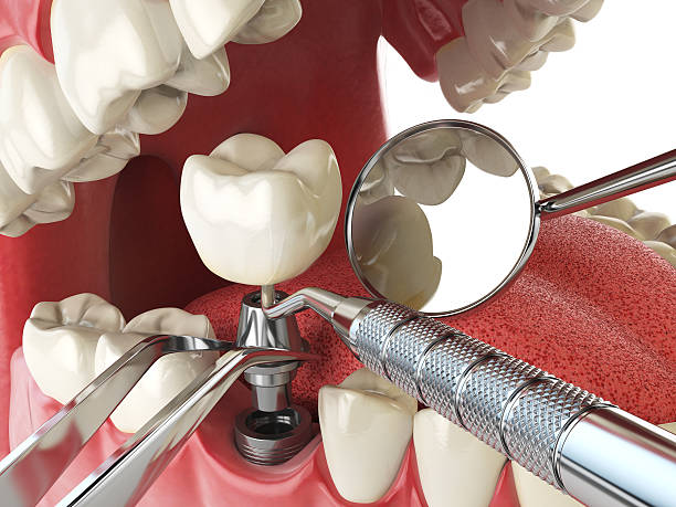 Best Emergency Treatment for Jaw Pain or Injury in Long Creek, IL