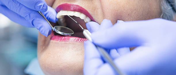 Best Broken or Chipped Tooth Repair in Long Creek, IL